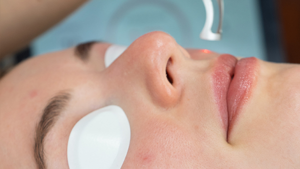 woman receiving laser genesis sydney